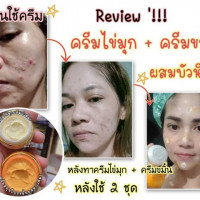 SKY ครีมไข่มุกผสมขมิ้น ของแท้ 100% กล่องละ 12 ชิ้น บรรจุ แพ็ค ชิ้นร้านค้าเครื่องสำอางค์ ขายเครื่องสำอาง สกินแคร์ ครีมกันแดด และเคาท์เตอร์แบรนด์ กว่า 2000 รายการ ของแท้ 100% เว็บเครื่องสำอาง ไอเท็มความงาม