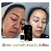 เอมิ ไฮยา เอสเซ้น เซรั่ม 15 มล. บรรจุ แพ็ค ชิ้นร้านค้าเครื่องสำอางค์ ขายเครื่องสำอาง สกินแคร์ ครีมกันแดด และเคาท์เตอร์แบรนด์ กว่า 2000 รายการ ของแท้ 100% เว็บเครื่องสำอาง ไอเท็มความงาม