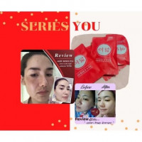 ครีมซีรี่ย์ยู ครีมลดสิว ฝ้า ครีมหน้าใส บรรจุ แพ็ค ชิ้นร้านค้าเครื่องสำอางค์ ขายเครื่องสำอาง สกินแคร์ ครีมกันแดด และเคาท์เตอร์แบรนด์ กว่า 2000 รายการ ของแท้ 100% เว็บเครื่องสำอาง ไอเท็มความงาม