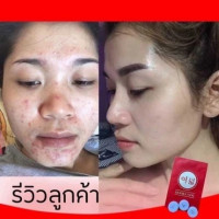 ซีรี่ย์ยู ครีม ขนาดทดลอง 6 กรัม บรรจุ แพ็ค ชิ้นร้านค้าเครื่องสำอางค์ ขายเครื่องสำอาง สกินแคร์ ครีมกันแดด และเคาท์เตอร์แบรนด์ กว่า 2000 รายการ ของแท้ 100% เว็บเครื่องสำอาง ไอเท็มความงาม