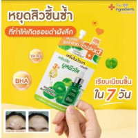 ดิ อินกรีเดียนส์ ซิก้า ทรีพลัส แอคเน่ เซรั่ม บรรจุ แพ็ค ชิ้นร้านค้าเครื่องสำอางค์ ขายเครื่องสำอาง สกินแคร์ ครีมกันแดด และเคาท์เตอร์แบรนด์ กว่า 2000 รายการ ของแท้ 100% เว็บเครื่องสำอาง ไอเท็มความงาม