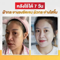 ครีมโสมออร่า มหัศจรรย์ โสมจากเกาหลี ช่วยฟื้นฟูผิวให้กลับมา ขาวเนียน กระจ่างใส บรรจุ แพ็ค ชิ้นร้านค้าเครื่องสำอางค์ ขายเครื่องสำอาง สกินแคร์ ครีมกันแดด และเคาท์เตอร์แบรนด์ กว่า 2000 รายการ ของแท้ 100% เว็บเครื่องสำอาง ไอเท็มความงาม