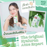 น้ำตบสิว น้ำตบใบเฟิร์น The Original Hyaluron Acne Expert กล่องละ 6 ซอง บรรจุ แพ็ค ชิ้นร้านค้าเครื่องสำอางค์ ขายเครื่องสำอาง สกินแคร์ ครีมกันแดด และเคาท์เตอร์แบรนด์ กว่า 2000 รายการ ของแท้ 100% เว็บเครื่องสำอาง ไอเท็มความงาม
