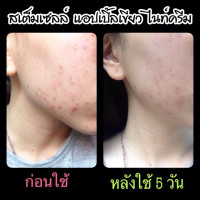 สเต็มเซลล์ แอปเปิ้ลเขียว ไนท์ครีม(1แพคมี6กล่อง) บรรจุ แพ็ค ชิ้นร้านค้าเครื่องสำอางค์ ขายเครื่องสำอาง สกินแคร์ ครีมกันแดด และเคาท์เตอร์แบรนด์ กว่า 2000 รายการ ของแท้ 100% เว็บเครื่องสำอาง ไอเท็มความงาม