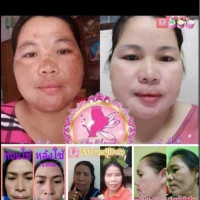 ครีมนางฟ้าเดอะแองเจิ้ล ลดสิว ฝ้า กระ บรรจุ แพ็ค ชิ้นร้านค้าเครื่องสำอางค์ ขายเครื่องสำอาง สกินแคร์ ครีมกันแดด และเคาท์เตอร์แบรนด์ กว่า 2000 รายการ ของแท้ 100% เว็บเครื่องสำอาง ไอเท็มความงาม