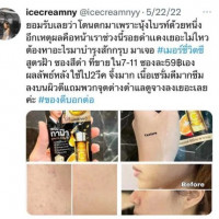 merci เซรั่มทาฝ้า เมลาสม่า& ดาร์ค สปอต บรรจุ แพ็ค ชิ้นร้านค้าเครื่องสำอางค์ ขายเครื่องสำอาง สกินแคร์ ครีมกันแดด และเคาท์เตอร์แบรนด์ กว่า 2000 รายการ ของแท้ 100% เว็บเครื่องสำอาง ไอเท็มความงาม