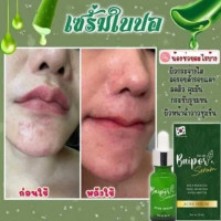เซรั่ม ใบปอ ออร์แกนิค สูตร สิว บรรจุ แพ็ค ชิ้นร้านค้าเครื่องสำอางค์ ขายเครื่องสำอาง สกินแคร์ ครีมกันแดด และเคาท์เตอร์แบรนด์ กว่า 2000 รายการ ของแท้ 100% เว็บเครื่องสำอาง ไอเท็มความงาม