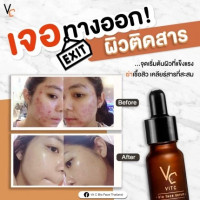 RATCHA Vit C Bio Face Serum รัชชา วิตซี ไบโอ เฟส เซรั่ม บรรจุ แพ็ค ชิ้นร้านค้าเครื่องสำอางค์ ขายเครื่องสำอาง สกินแคร์ ครีมกันแดด และเคาท์เตอร์แบรนด์ กว่า 2000 รายการ ของแท้ 100% เว็บเครื่องสำอาง ไอเท็มความงาม