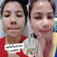 Serum Centella Asiatica 98% Pontina by Pontip เซรั่มใบบัวบก บรรจุ แพ็ค ชิ้นร้านค้าเครื่องสำอางค์ ขายเครื่องสำอาง สกินแคร์ ครีมกันแดด และเคาท์เตอร์แบรนด์ กว่า 2000 รายการ ของแท้ 100% เว็บเครื่องสำอาง ไอเท็มความงาม
