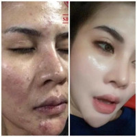 ครีมซีรี่ย์ยู ครีมลดสิว ฝ้า ครีมหน้าใส บรรจุ แพ็ค ชิ้นร้านค้าเครื่องสำอางค์ ขายเครื่องสำอาง สกินแคร์ ครีมกันแดด และเคาท์เตอร์แบรนด์ กว่า 2000 รายการ ของแท้ 100% เว็บเครื่องสำอาง ไอเท็มความงาม
