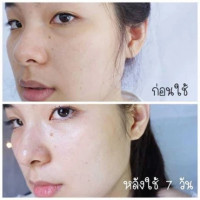 MERCI Vitamin C Extra Bright Serum เมอร์ซี่ วิตามินซี เอ็กซ์ตร้า ไบร์ท เซรั่ม เซรั่มวิตซี บรรจุ แพ็ค ชิ้นร้านค้าเครื่องสำอางค์ ขายเครื่องสำอาง สกินแคร์ ครีมกันแดด และเคาท์เตอร์แบรนด์ กว่า 2000 รายการ ของแท้ 100% เว็บเครื่องสำอาง ไอเท็มความงาม