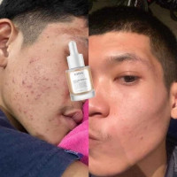 เรยา Rayya เซรั่ม เซรั่มรีจูรัน เซรั่มหน้าฉํ่า บำรุงผิวหน้า หน้าใส 15ml. บรรจุ แพ็ค ชิ้นร้านค้าเครื่องสำอางค์ ขายเครื่องสำอาง สกินแคร์ ครีมกันแดด และเคาท์เตอร์แบรนด์ กว่า 2000 รายการ ของแท้ 100% เว็บเครื่องสำอาง ไอเท็มความงาม