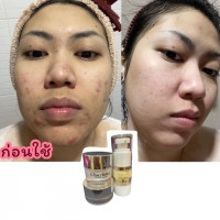 CHARLOTTE VITAMIN B3 TESTER บรรจุ แพ็ค ชิ้นร้านค้าเครื่องสำอางค์ ขายเครื่องสำอาง สกินแคร์ ครีมกันแดด และเคาท์เตอร์แบรนด์ กว่า 2000 รายการ ของแท้ 100% เว็บเครื่องสำอาง ไอเท็มความงาม