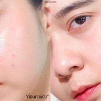 พอนด์ส ดูอัล แอคเน่ แอนด์ ออยล์ โซลูชั่น อัลตร้า แมท เฟเชี่ยล พาวเดอร์ 50 กรัมร้านค้าเครื่องสำอางค์ ขายเครื่องสำอาง สกินแคร์ ครีมกันแดด และเคาท์เตอร์แบรนด์ กว่า 2000 รายการ ของแท้ 100% เว็บเครื่องสำอาง ไอเท็มความงาม