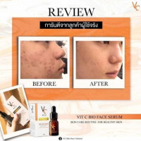 RATCHA Vit C Bio Face Serum รัชชา วิตซี ไบโอ เฟส เซรั่ม บรรจุ แพ็ค ชิ้นร้านค้าเครื่องสำอางค์ ขายเครื่องสำอาง สกินแคร์ ครีมกันแดด และเคาท์เตอร์แบรนด์ กว่า 2000 รายการ ของแท้ 100% เว็บเครื่องสำอาง ไอเท็มความงาม