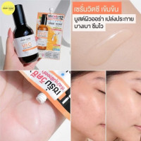 เซรั่มวิตซีเคลียร์โนส Clear Nose Vitamin C Serum สูตรเข้มข้น ผิวกระจ่างใส แบบซอง 8g บรรจุ แพ็ค ชิ้นร้านค้าเครื่องสำอางค์ ขายเครื่องสำอาง สกินแคร์ ครีมกันแดด และเคาท์เตอร์แบรนด์ กว่า 2000 รายการ ของแท้ 100% เว็บเครื่องสำอาง ไอเท็มความงาม