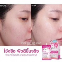 เค.เอ. ไวท์ รีเซ็ต สกินครีม KA White Reset Skin Cream บรรจุ แพ็ค ชิ้นร้านค้าเครื่องสำอางค์ ขายเครื่องสำอาง สกินแคร์ ครีมกันแดด และเคาท์เตอร์แบรนด์ กว่า 2000 รายการ ของแท้ 100% เว็บเครื่องสำอาง ไอเท็มความงาม
