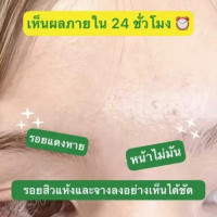 เมอร์ซี่ วิตามินซีพลัส แอนตี้แอคเน่ เอ็กซ์ตร้า ไบร์ท เซรั่ม บรรจุ แพ็ค ชิ้นร้านค้าเครื่องสำอางค์ ขายเครื่องสำอาง สกินแคร์ ครีมกันแดด และเคาท์เตอร์แบรนด์ กว่า 2000 รายการ ของแท้ 100% เว็บเครื่องสำอาง ไอเท็มความงาม