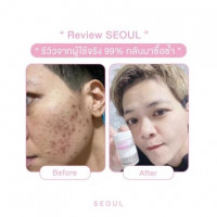 โซล ไวท์ ครีม /โซลออแกนิคครีม บรรจุ แพ็ค ชิ้นร้านค้าเครื่องสำอางค์ ขายเครื่องสำอาง สกินแคร์ ครีมกันแดด และเคาท์เตอร์แบรนด์ กว่า 2000 รายการ ของแท้ 100% เว็บเครื่องสำอาง ไอเท็มความงาม