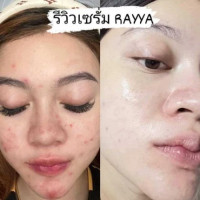 เรยา Rayya เซรั่ม เซรั่มรีจูรัน เซรั่มหน้าฉํ่า บำรุงผิวหน้า หน้าใส 15ml. บรรจุ แพ็ค ชิ้นร้านค้าเครื่องสำอางค์ ขายเครื่องสำอาง สกินแคร์ ครีมกันแดด และเคาท์เตอร์แบรนด์ กว่า 2000 รายการ ของแท้ 100% เว็บเครื่องสำอาง ไอเท็มความงาม