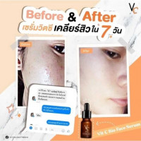 RATCHA Vit C Bio Face Serum รัชชา วิตซี ไบโอ เฟส เซรั่ม บรรจุ แพ็ค ชิ้นร้านค้าเครื่องสำอางค์ ขายเครื่องสำอาง สกินแคร์ ครีมกันแดด และเคาท์เตอร์แบรนด์ กว่า 2000 รายการ ของแท้ 100% เว็บเครื่องสำอาง ไอเท็มความงาม