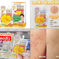 Jula s Herb จุฬาเฮิร์บ เจลลดสิวดาวเรือง บรรจุ แพ็ค ชิ้นร้านค้าเครื่องสำอางค์ ขายเครื่องสำอาง สกินแคร์ ครีมกันแดด และเคาท์เตอร์แบรนด์ กว่า 2000 รายการ ของแท้ 100% เว็บเครื่องสำอาง ไอเท็มความงาม