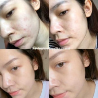 สูตรใหม่ เซรั่มสตรอ เยอเพล Yerpall เซรั่มสตอเบอร์รี่ บรรจุ แพ็ค ชิ้นร้านค้าเครื่องสำอางค์ ขายเครื่องสำอาง สกินแคร์ ครีมกันแดด และเคาท์เตอร์แบรนด์ กว่า 2000 รายการ ของแท้ 100% เว็บเครื่องสำอาง ไอเท็มความงาม