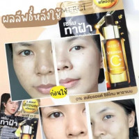 merci เซรั่มทาฝ้า เมลาสม่า& ดาร์ค สปอต บรรจุ แพ็ค ชิ้นร้านค้าเครื่องสำอางค์ ขายเครื่องสำอาง สกินแคร์ ครีมกันแดด และเคาท์เตอร์แบรนด์ กว่า 2000 รายการ ของแท้ 100% เว็บเครื่องสำอาง ไอเท็มความงาม