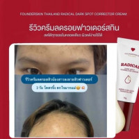 ครีมลดรอย RADICAL ฟาวน์เดอร์สกิน Founderskin บรรจุ แพ็ค ชิ้นร้านค้าเครื่องสำอางค์ ขายเครื่องสำอาง สกินแคร์ ครีมกันแดด และเคาท์เตอร์แบรนด์ กว่า 2000 รายการ ของแท้ 100% เว็บเครื่องสำอาง ไอเท็มความงาม
