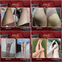 ครีมโสมพิษผึ้งจักรพรรดิ skin dose ผิวขาวใส ออร่าร้านค้าเครื่องสำอางค์ ขายเครื่องสำอาง สกินแคร์ ครีมกันแดด และเคาท์เตอร์แบรนด์ กว่า 2000 รายการ ของแท้ 100% เว็บเครื่องสำอาง ไอเท็มความงาม